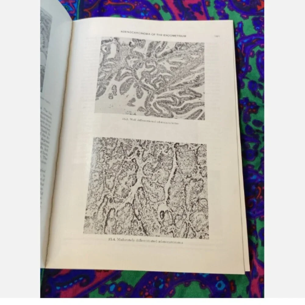 Gynecology Condensed Novak's Textbook Vintage Medical Reference 1975 9th Edition